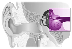 Sensorineural Hearing Loss